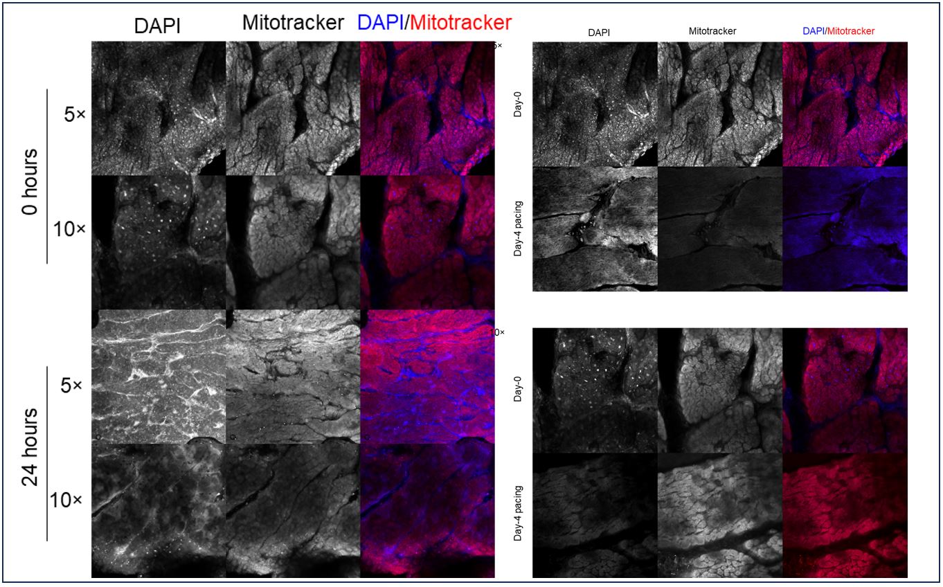 DAPI mitrotracker image