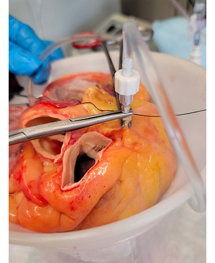 canulating myocardium