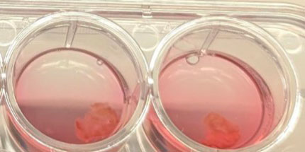 cardiac tissue slices in culture