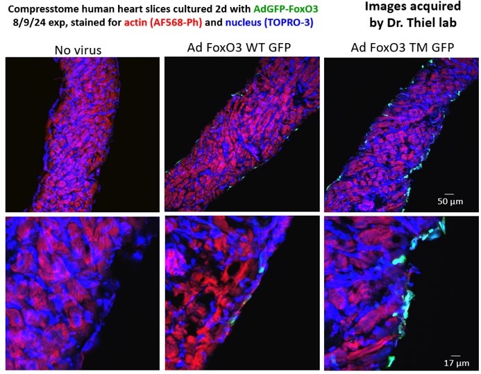 Cultured human heart slices